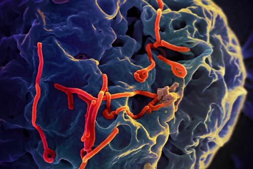 埃博拉病毒怎么消失了 埃博拉病毒有疫苗了吗
