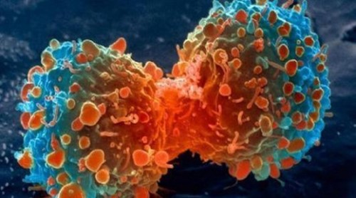 海拉细胞污染事件揭秘 注射癌细胞人体实验骇人听闻