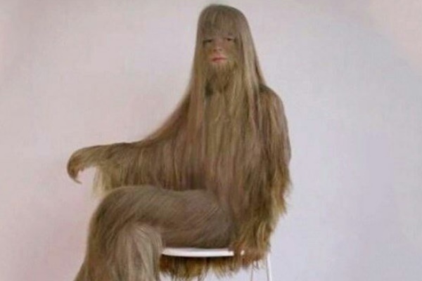 世界上最长的体毛:毛发似头发般生长剃毛后变美女