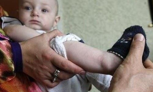 俄罗斯婴儿腿上皮肤能显示古兰经经文 胎记惊现经文/真主显灵