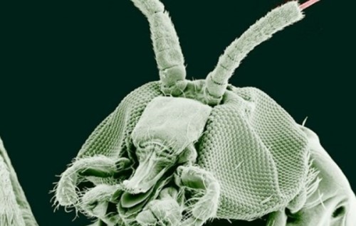 人体寄生虫有哪些种类？寄生虫对人体的十大危害