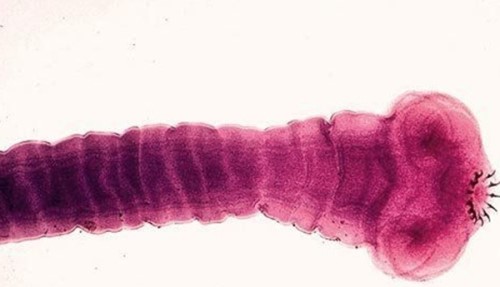人体寄生虫有哪些种类？寄生虫对人体的十大危害