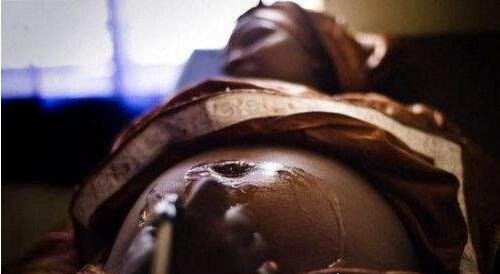 降低性欲的非洲女性割礼 竟是男人对性欲的需求