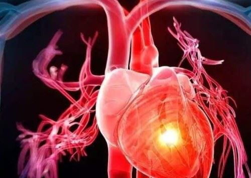 心脏病是怎么引起的？心脏病人的十大注意事项