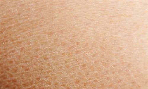 皮肤起皮屑怎么办 预防皮肤起皮屑的方法？有哪些