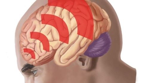 脑震荡多久能恢复正常？脑震荡对人体的十大危害