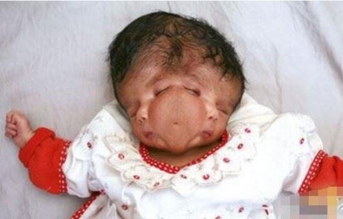 澳大利亚怪婴之谜 女子产下双面婴儿两张脸/一个身体