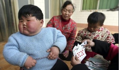 山西运城两岁女童重41.5公斤 2岁女童体重82斤肥胖病