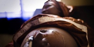 非洲的女性割礼是什么？意思呢 破坏女性敏感部位(残忍至极)