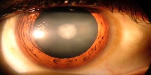 关于眼睛的12个疯狂事实 每只眼睛都含有1.07亿个细胞